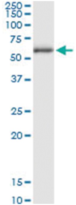 anti-CCT8L2, Human, IP-WB Antibody Pair, Abnova™