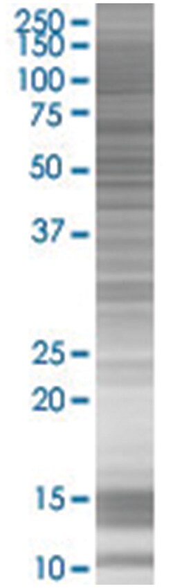 NFAM1 293T Cell Overexpression Lysate (Denatured), Abnova 100 &mu;l | Buy Online | Abnova | Fisher Scientific