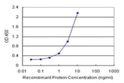 anti-COMMD1 Matched Antibody Pair, Ab-1, Abnova