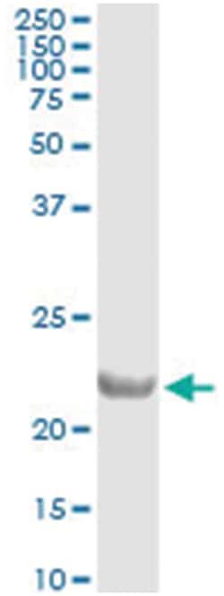 COMMD1, Human, IP-WB Antibody Pair (PW1), Abnova&trade;