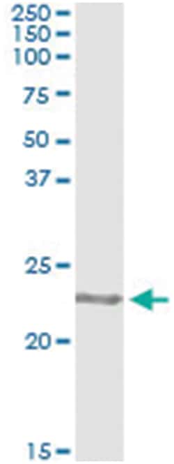 COMMD1, Human, IP-WB Antibody Pair (PW2), Abnova&trade;