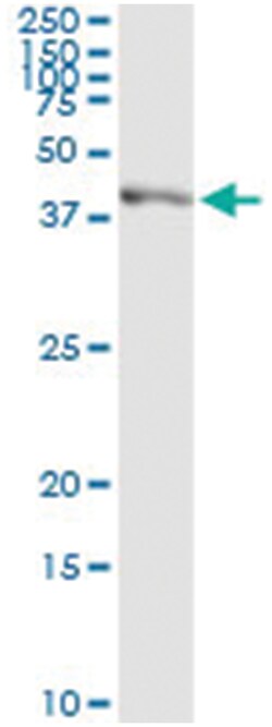 SGOL1, Human, IP-WB Antibody Pair (PW2), Abnova™