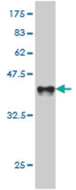 B and T lymphocyte associated, Mouse, Clone: 1B7, Abnova 100&mu;g; Unlabeled:Antibodies,