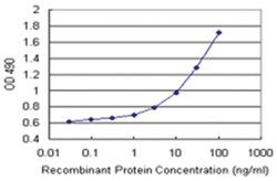 anti-NEK10 Matched Antibody Pair, Abnova&trade;
