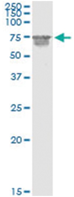 CNKSR3, Human, IP-WB Antibody Pair (PW1), Abnova&trade;