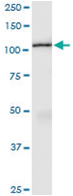 anti-AMOTL1, Human, IP-WB Antibody Pair, Abnova&trade;