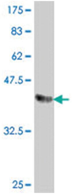 FBXO16, Mouse, Polyclonal Antibody, Abnova 50 &mu;L | Buy Online | Abnova Corporation | Fisher Scientific