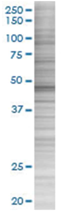 C9ORF98 293T Cell Overexpression Lysate (Denatured), Abnova 100 &mu;L | Buy Online | Abnova | Fisher Scientific