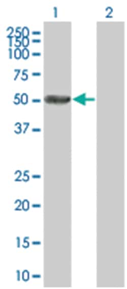 C9ORF98 293T Cell Overexpression Lysate (Denatured), Abnova 100 &mu;L | Buy Online | Abnova | Fisher Scientific
