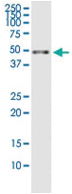 DYX1C1, Human, IP-WB Antibody Pair (PW3), Abnova&trade;
