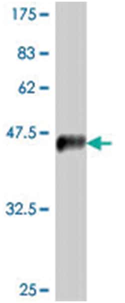 interleukin 28 receptor, alpha (interferon, lambda receptor), Mouse, Polyclonal