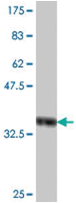 SNX31 (MGC39715), Mouse, Polyclonal Antibody, Abnova 50&mu;L; Unlabeled:Antibodies,