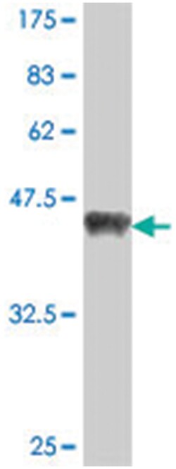 SPRED2, Mouse, Polyclonal Antibody, Abnova 50&mu;L; Unlabeled:Antibodies,