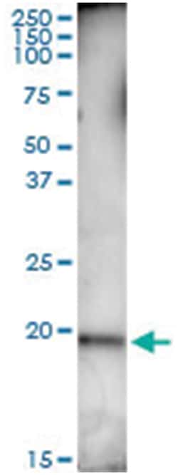 anti-STK32A, Human, IP-WB Antibody Pair, Abnova&trade;