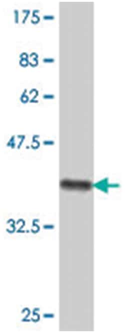 NRK, Mouse, Polyclonal Antibody, Abnova 50&mu;L; Unlabeled:Antibodies,