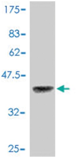 UNC5B, Mouse, Polyclonal Antibody, Abnova 50&mu;L; Unlabeled:Antibodies,