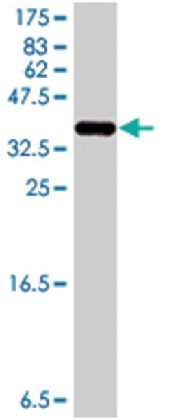 MARCH8, Mouse, Polyclonal Antibody, Abnova 50 &mu;L | Buy Online | Abnova Corporation | Fisher Scientific