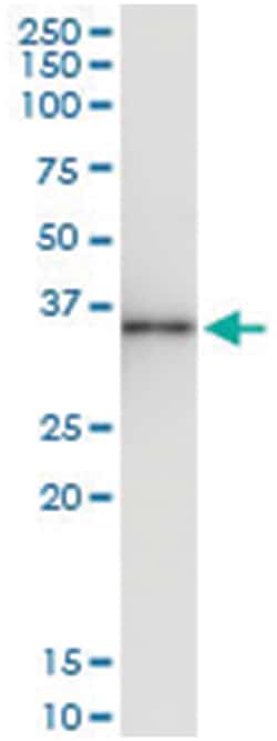 anti-ALKBH3, Human, IP-WB Antibody Pair, Abnova&trade;