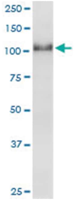 anti-RFX6, Human, IP-WB Antibody Pair, Abnova&trade;