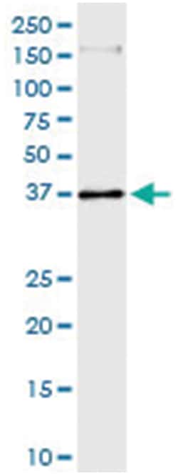anti-ATP6V1C2, Human, IP-WB Antibody Pair, Abnova&trade;