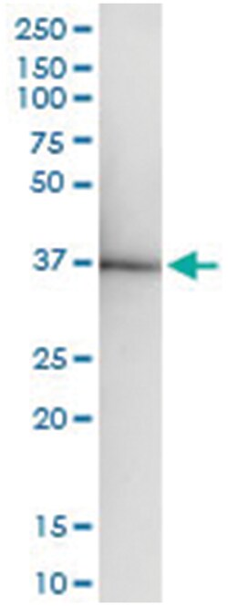anti-ZNF396, Human, IP-WB Antibody Pair, Abnova™