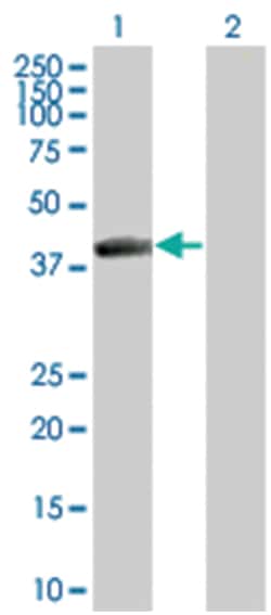 NEIL2 293T Cell Overexpression Lysate (Denatured), Abnova 100 &mu;L | Buy Online | Abnova | Fisher Scientific