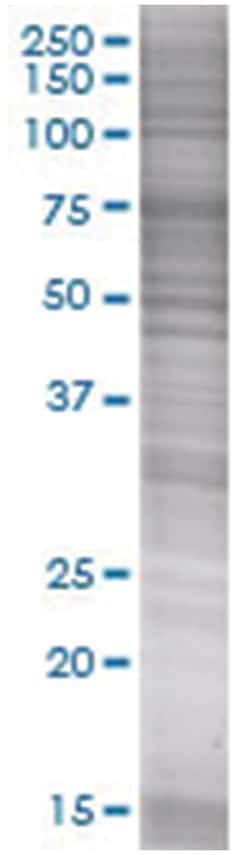 STXBP4 293T Cell Overexpression Lysate (Denatured), Abnova 100 &mu;L | Buy Online | Abnova | Fisher Scientific