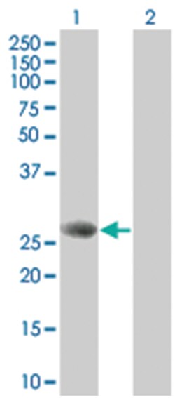 STXBP4 293T Cell Overexpression Lysate (Denatured), Abnova 100 &mu;L | Buy Online | Abnova | Fisher Scientific