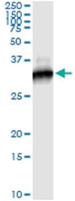 anti-RICTOR, Human, IP-WB Antibody Pair, Abnova&trade;