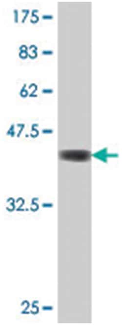 IPMK, Mouse, Polyclonal Antibody, Abnova 50&mu;L; Unlabeled:Antibodies,