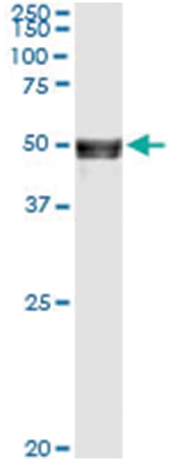 anti-ANGPTL5, Human, IP-WB Antibody Pair, Abnova&trade;