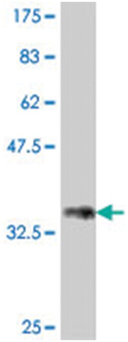 RNF169 (KIAA1991), Mouse, Polyclonal Antibody, Abnova 50&mu;L; Unlabeled:Antibodies,