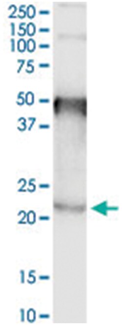anti-TMEM86B, Human, IP-WB Antibody Pair, Abnova&trade;