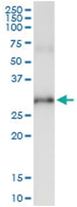 anti-RNF144B, Human, IP-WB Antibody Pair, Abnova&trade;