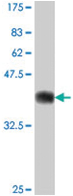RNF214 (DKFZp547C195), Mouse, Polyclonal Antibody, Abnova 50&mu;L; Unlabeled:Antibodies,