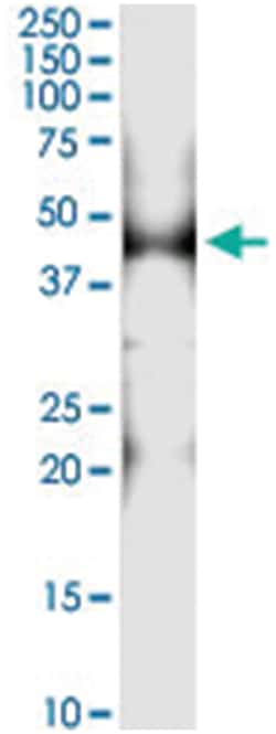 PTRF, Human, IP-WB Antibody Pair (PW2), Abnova™