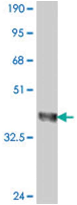 IGSF10, Mouse, Polyclonal Antibody, Abnova 50&mu;L; Unlabeled:Antibodies,