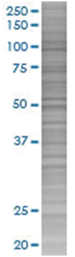 LOC285498 293T Cell Overexpression Lysate (Denatured), Abnova 100 &mu;L | Buy Online | Abnova | Fisher Scientific
