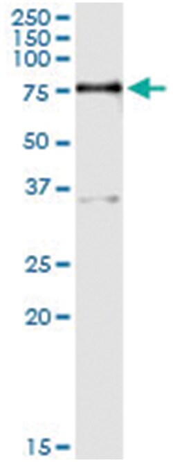 anti-PPM1J, Human, IP-WB Antibody Pair, Abnova 1 Set:Antibodies, Monoclonal/Polyclonal