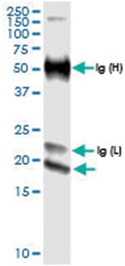 IFNE, Human, IP-WB Antibody Pair (PW1), Abnova&trade;