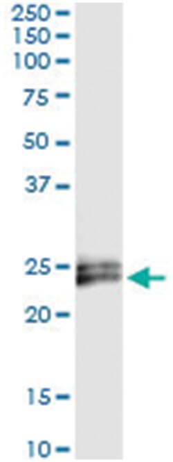 IFNE, Human, IP-WB Antibody Pair (PW2), Abnova™
