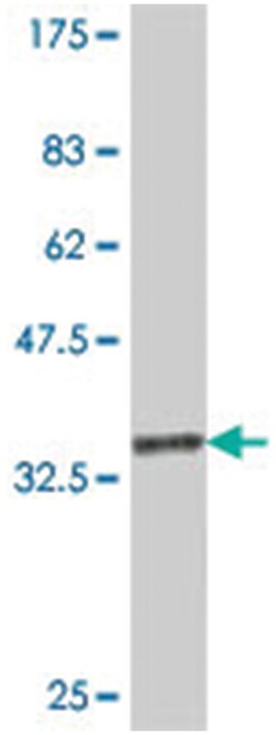 RAB7B, Mouse, Polyclonal Antibody, Abnova 50μL; Unlabeled:Antibodies,