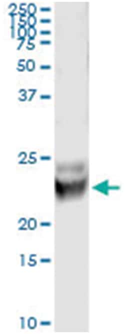 anti-RAB7B, Human, IP-WB Antibody Pair, Abnova&trade;