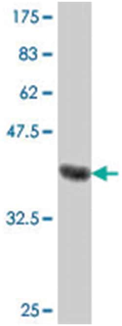 COLM, Mouse, Polyclonal Antibody, Abnova 50&mu;L; Unlabeled:Antibodies,