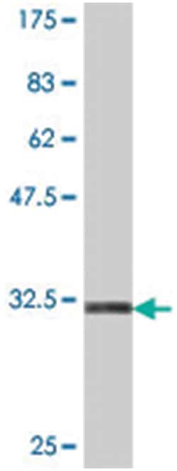 MOGAT3, Mouse, Polyclonal Antibody, Abnova 50&mu;L; Unlabeled:Antibodies,