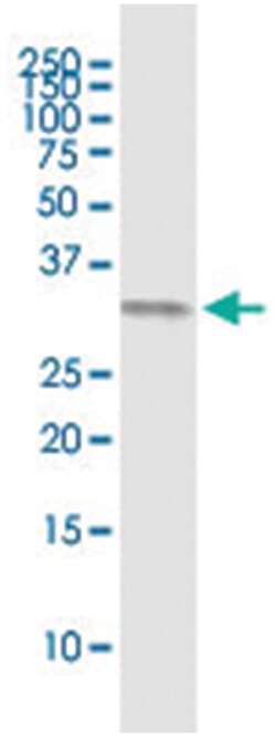 anti-TICAM2, Human, IP-WB Antibody Pair, Abnova&trade;
