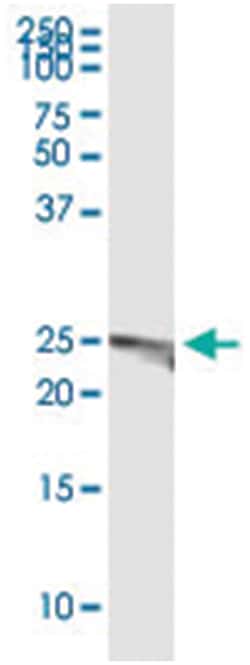 anti-GSTK1, Human, IP-WB Antibody Pair, Abnova&trade;