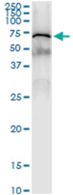 anti-SLC27A1, Human, IP-WB Antibody Pair, Abnova 1 Set:Antibodies, Monoclonal/Polyclonal