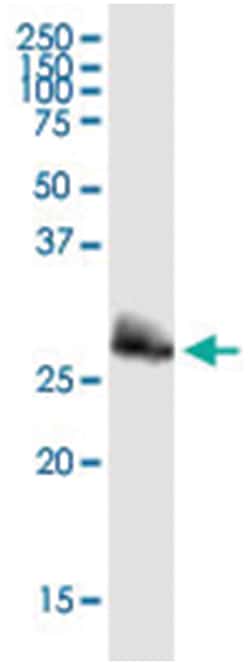 anti-KCTD4, Human, IP-WB Antibody Pair, Abnova&trade;