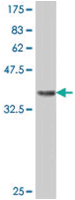 RNF207 (FLJ46380), Mouse, Polyclonal Antibody, Abnova 50&mu;L; Unlabeled:Antibodies,